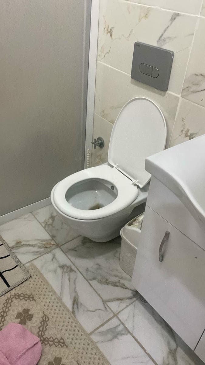 Tuvalet pimaş açma